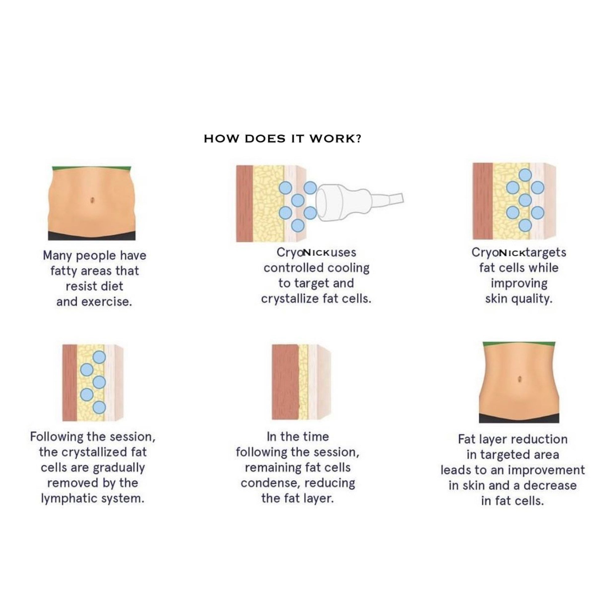 Cryonick Wellness Technology: Iceberg Cryonick Mini Roller