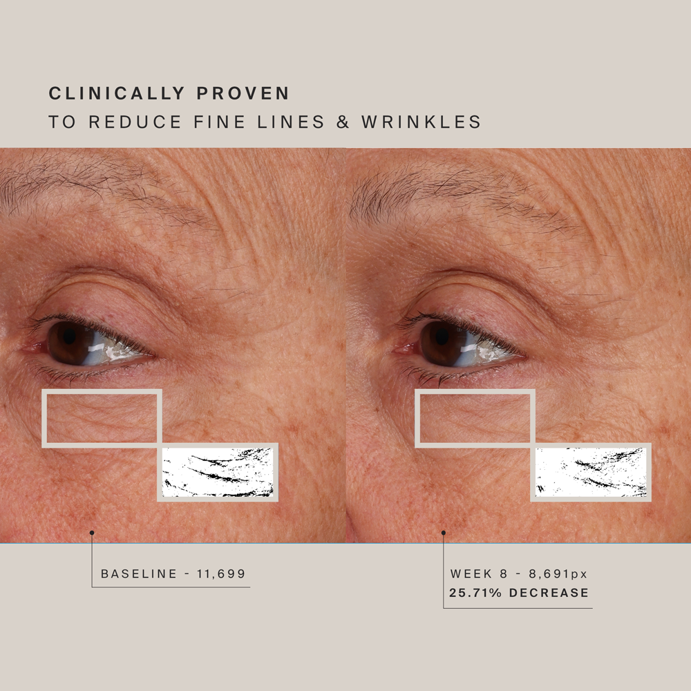 HigherDOSE Red Light Face Mask.