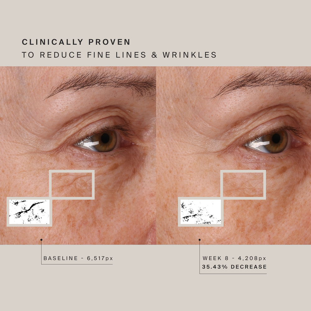 HigherDOSE Red Light Face Mask.