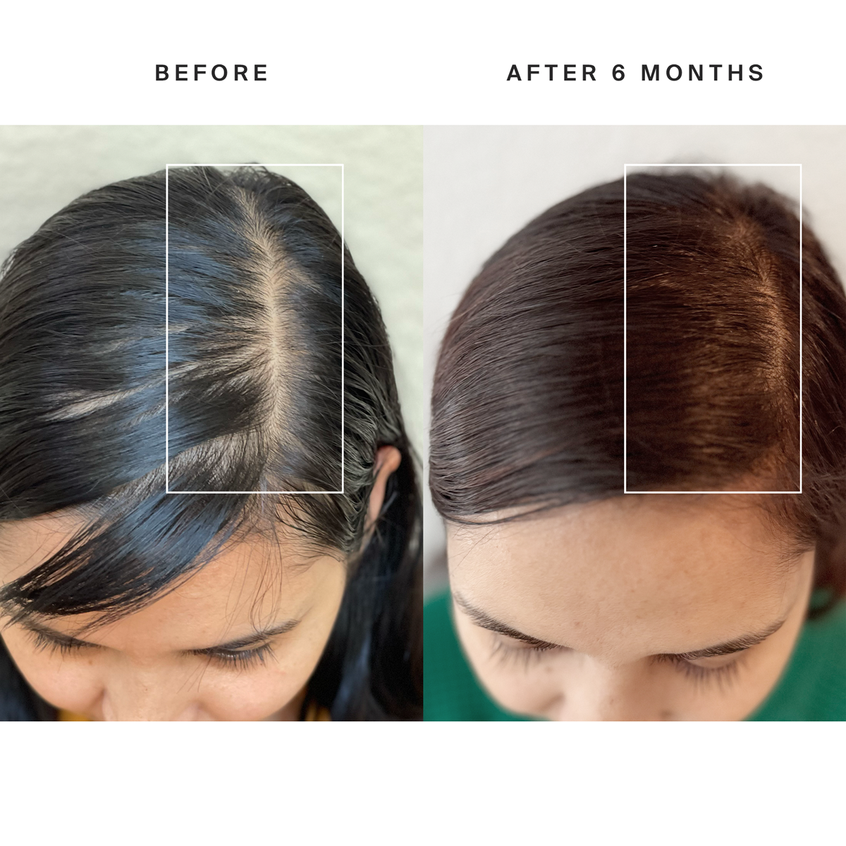 HigherDOSE Red Light Hat - Elite Holistic Fitness