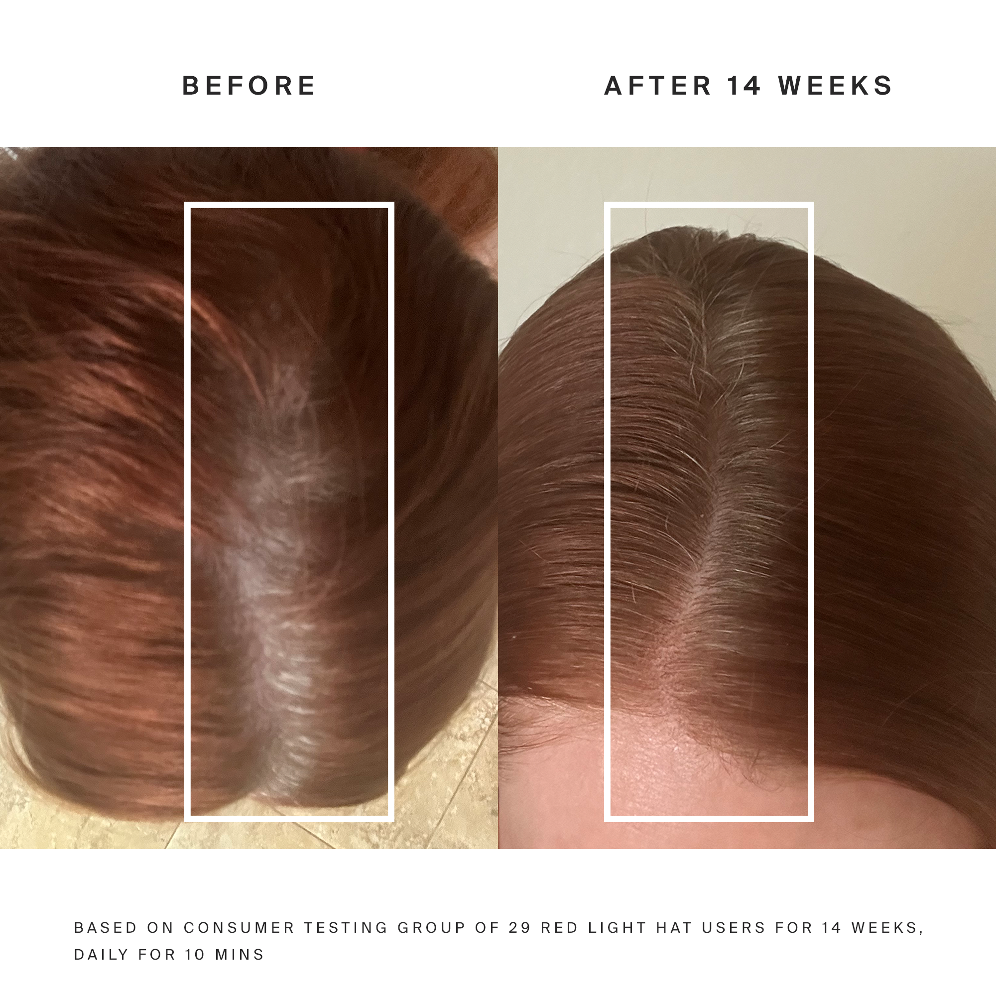 HigherDOSE Red Light Hat - Elite Holistic Fitness