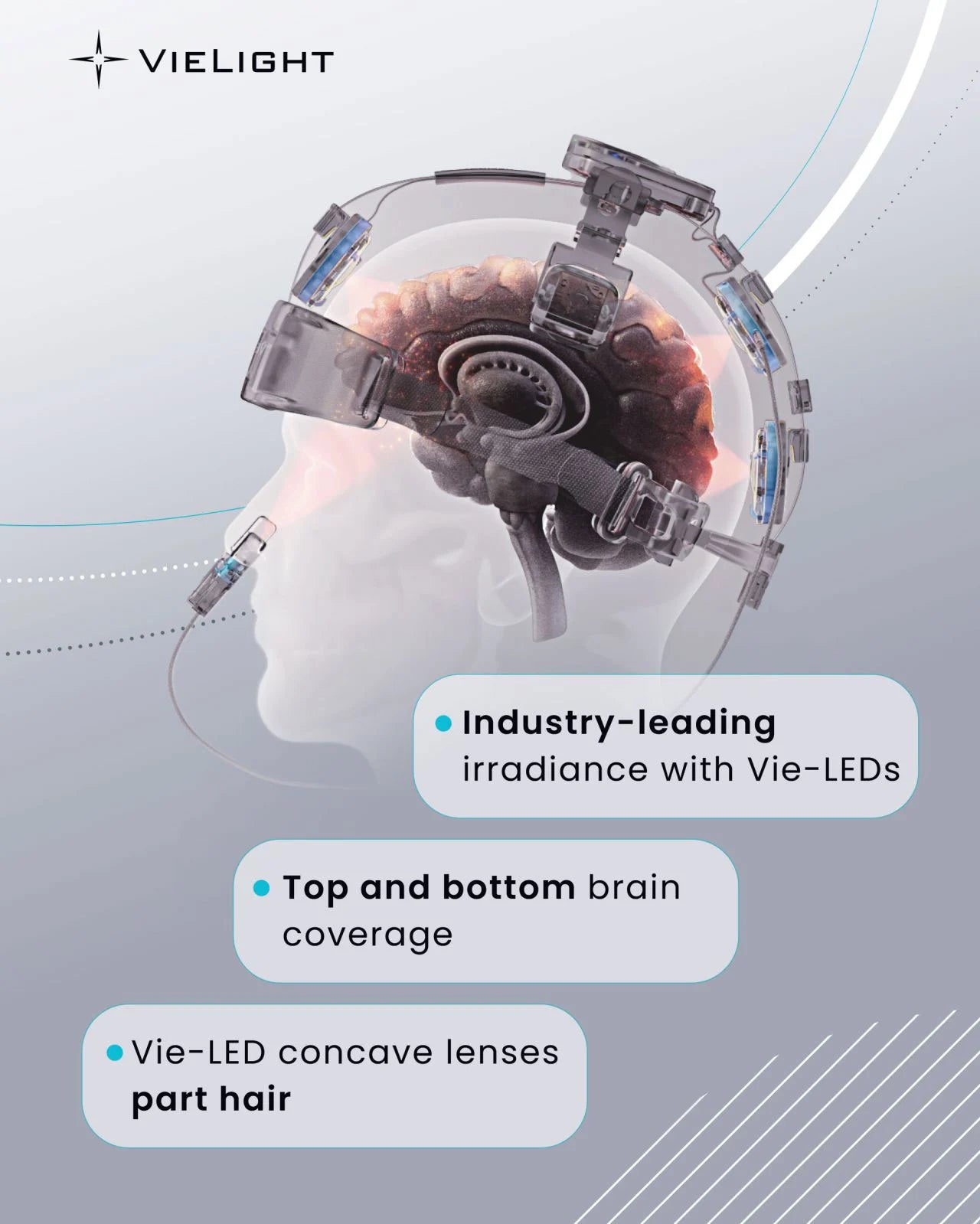 Vielight Neuro Duo 4 – Transcranial Photobiomodulation System