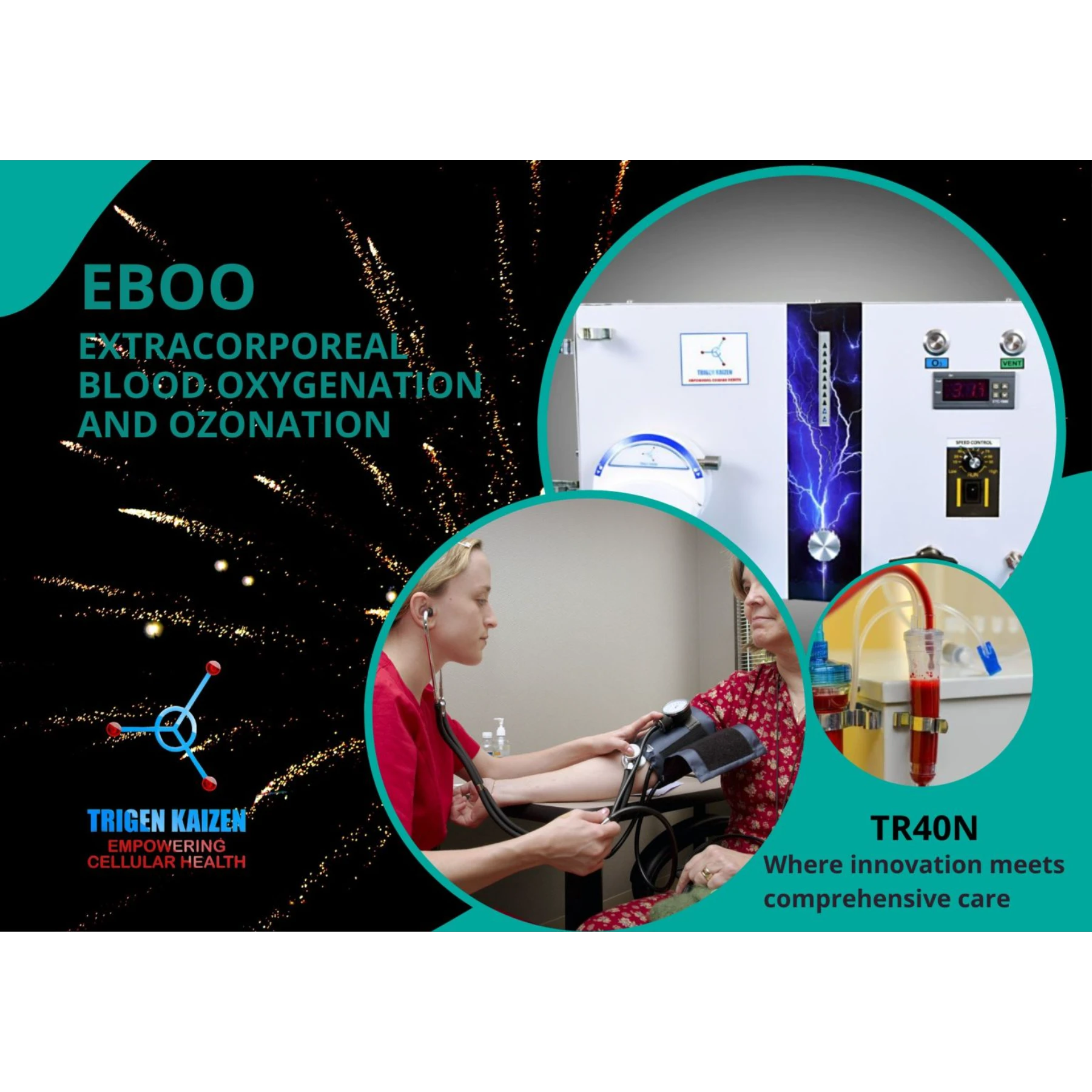 TrigenO3 EBOO System – Advanced Extracorporeal Blood Oxygenation & Ozonation